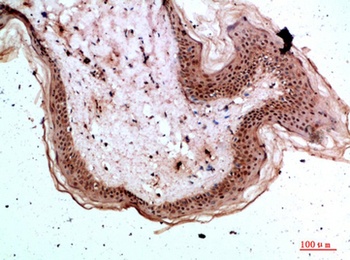 Tryptase-3 rabbit pAb