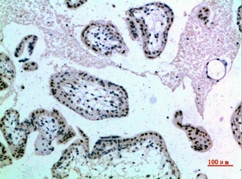 NOP56 rabbit pAb