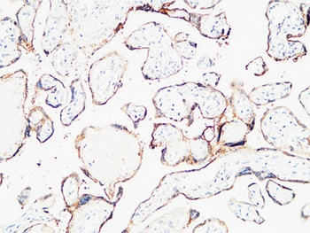 ETBR antibody