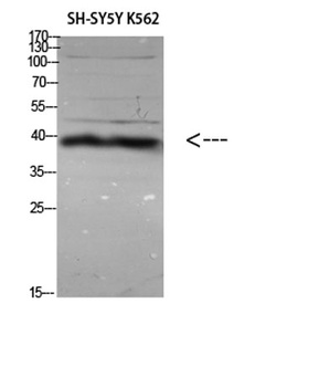 ERLIN1/2 rabbit pAb
