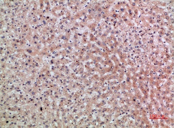 ERLIN1/2 antibody