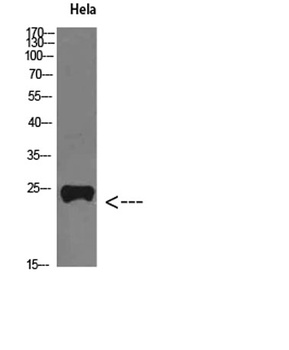 PTH-rP rabbit pAb Antibody