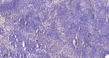 PTH-rP rabbit pAb