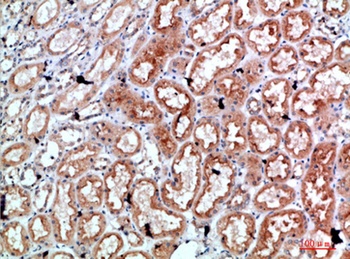 Perforin 1 antibody