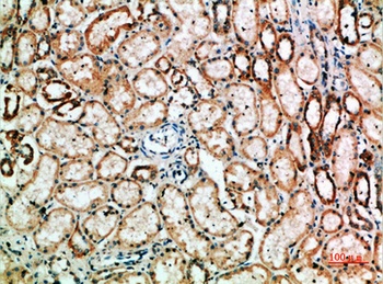 TyrRS antibody