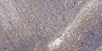 TIMP-4 rabbit pAb Antibody