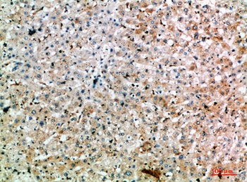 SPOP antibody