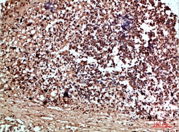 RCC1 rabbit pAb Antibody
