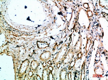 MIB1 antibody