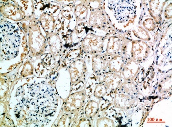 MIB1 antibody