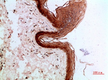 Cytokeratin 14/17 rabbit pAb