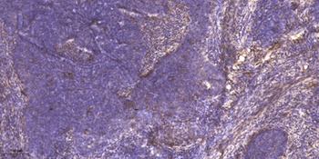 MYOZ2 antibody