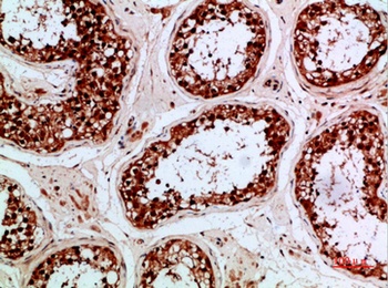 Enkephalin antibody