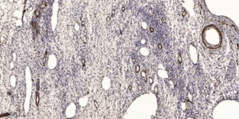 Enkephalin antibody