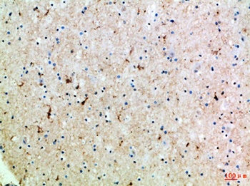 GABA T-1 antibody