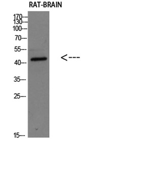 Corticotropin-releasing factor receptor 2 rabbit pAb Antibody