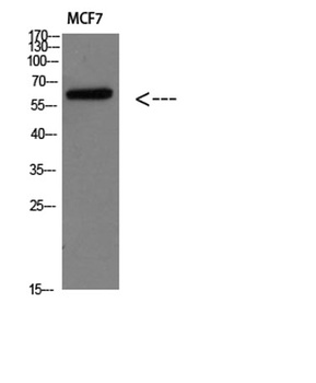 Parathyroid hormone/parathyroid hormone-related peptide receptor rabbit pAb Antibody