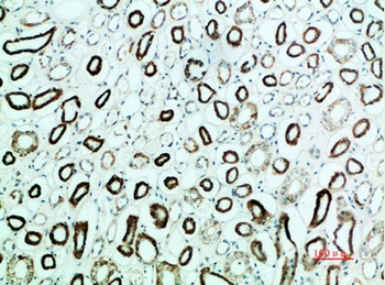 Parathyroid hormone/parathyroid hormone-related peptide receptor rabbit pAb Antibody
