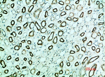 Parathyroid hormone/parathyroid hormone-related peptide receptor rabbit pAb Antibody