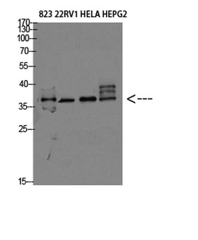 TMEPAI rabbit pAb Antibody