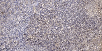 Sodium Potassium ATPase alpha-1 (Phospho-Tyr260) Antibody