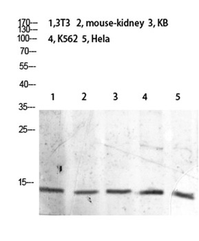 Histone H2B (Acetyl Lys21) rabbit pAb Antibody