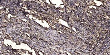 Keratin-pan antibody