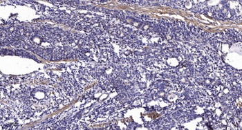 Ku-70 (Acetyl Lys317) rabbit pAb
