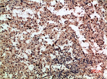 PF-4 rabbit pAb Antibody