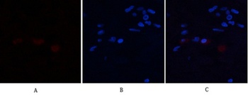 Annexin I antibody