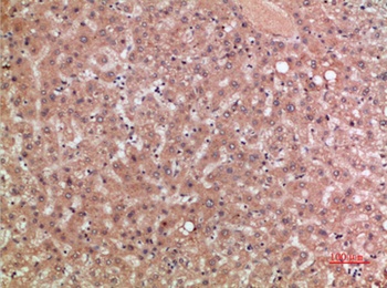 CKR-5 antibody