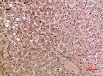 CKR-5 antibody