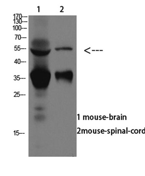 ASIC1 rabbit pAb Antibody