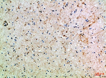 ASIC1 rabbit pAb Antibody