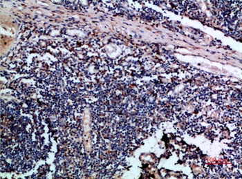 Cystatin A rabbit pAb