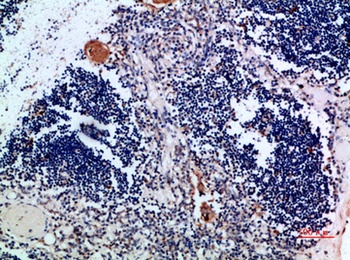Cystatin A rabbit pAb