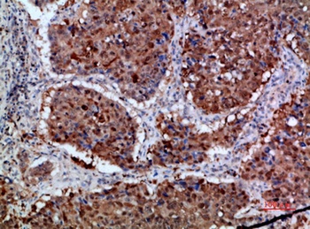 Integrin alpha 1 antibody