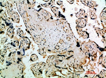 Flt-4 rabbit pAb Antibody