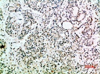 EGF antibody