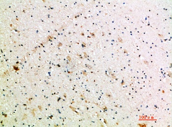 NT-3 antibody