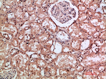 CD168 rabbit pAb