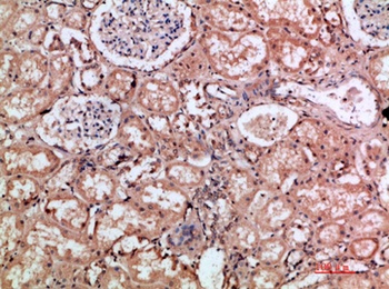 CD168 rabbit pAb