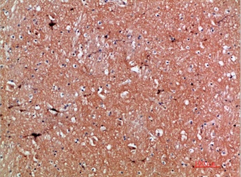 Tenascin-R rabbit pAb