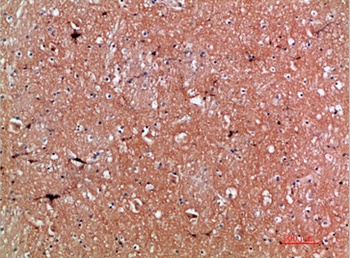 Tenascin-R antibody