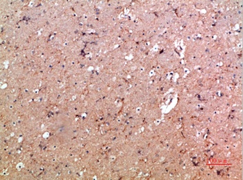 CD11b rabbit pAb