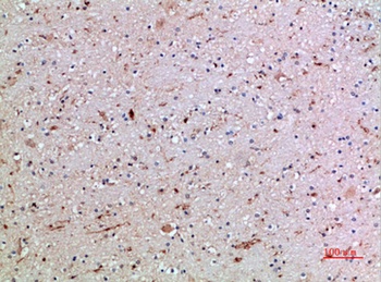CD16 rabbit pAb