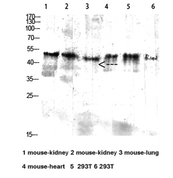 CD64 rabbit pAb Antibody