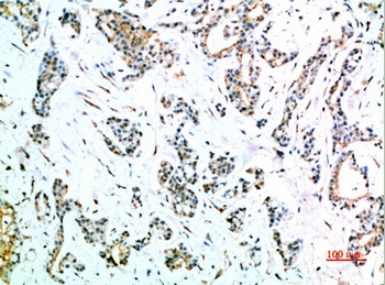 CD64 rabbit pAb Antibody