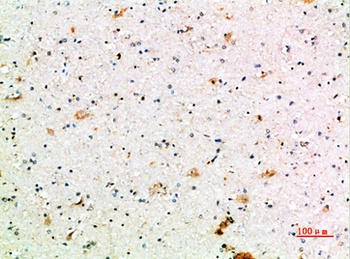CD64 rabbit pAb Antibody
