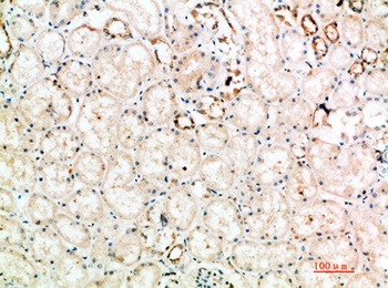 CTLA4 antibody